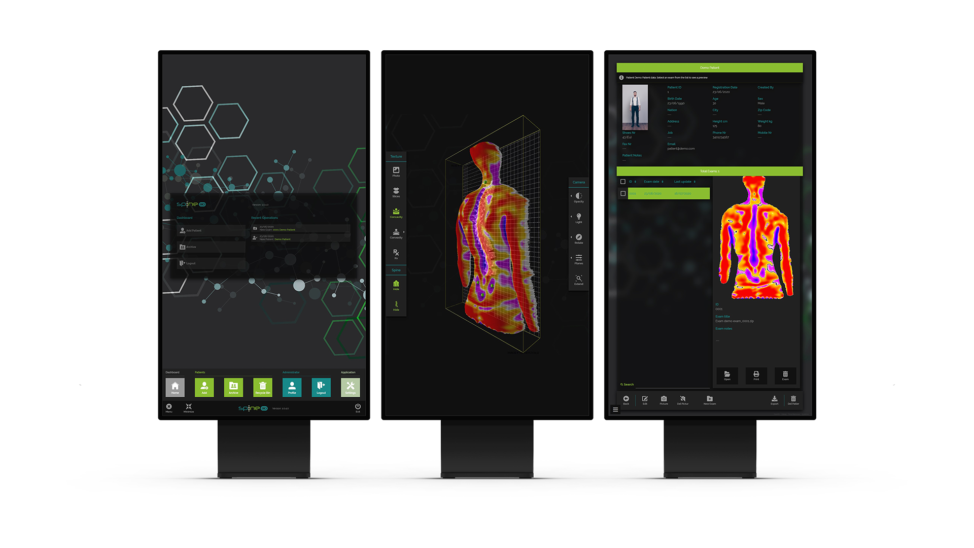 Spine 3D Posture Analysis from Sensor Medica